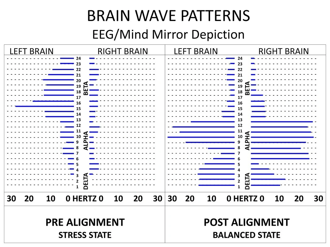 EEG/Mind Mirror educational depiction with left- and right-brain bar patterns, frequency labels, and panels labeled pre-alignment stress state and post-alignment balanced state.